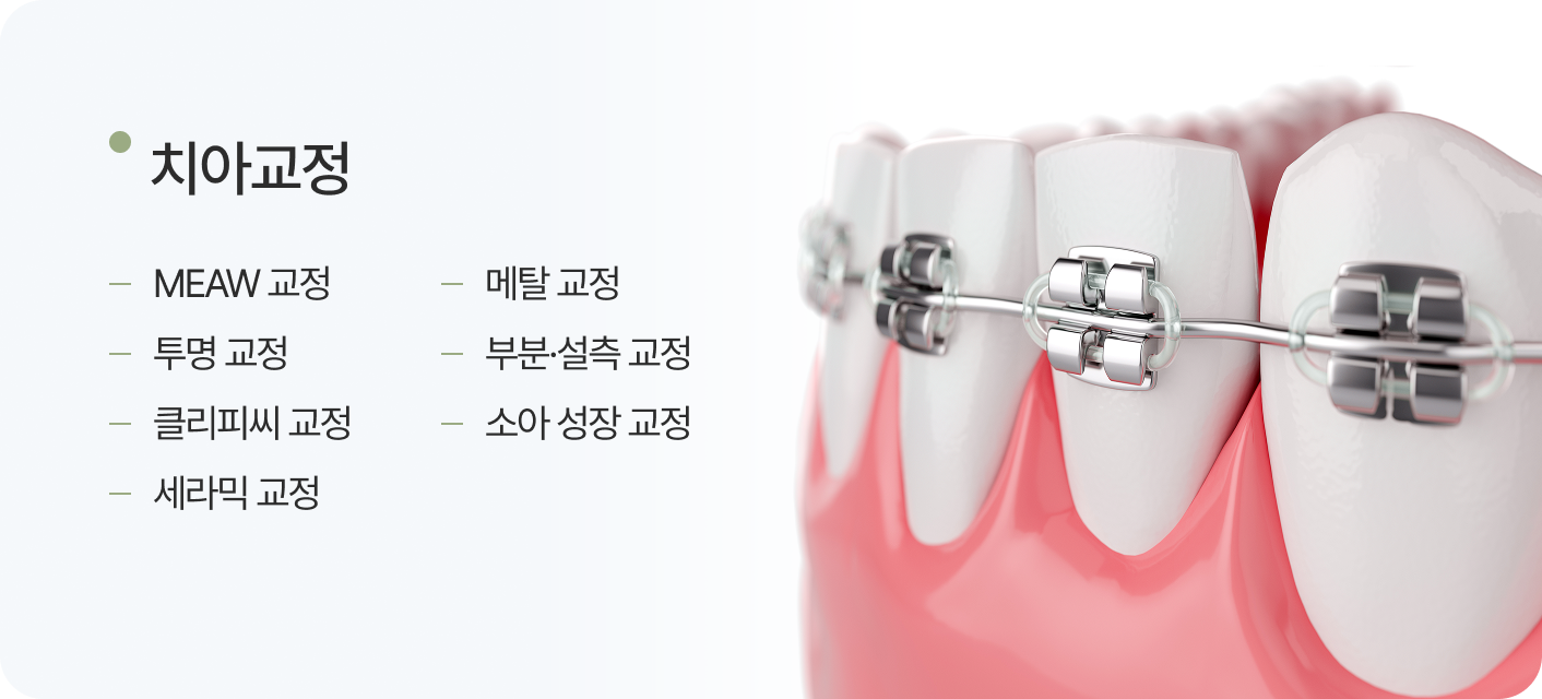치아교정, MEAW 교정, 메탈 교정, 투명 교정, 부분 설측교정, 클리피씨 교정, 소아 성장 교정, 세라믹 교정